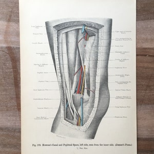 1906 Antique Medical print, Leg and knee print - Human body print, Anatomy Engraving