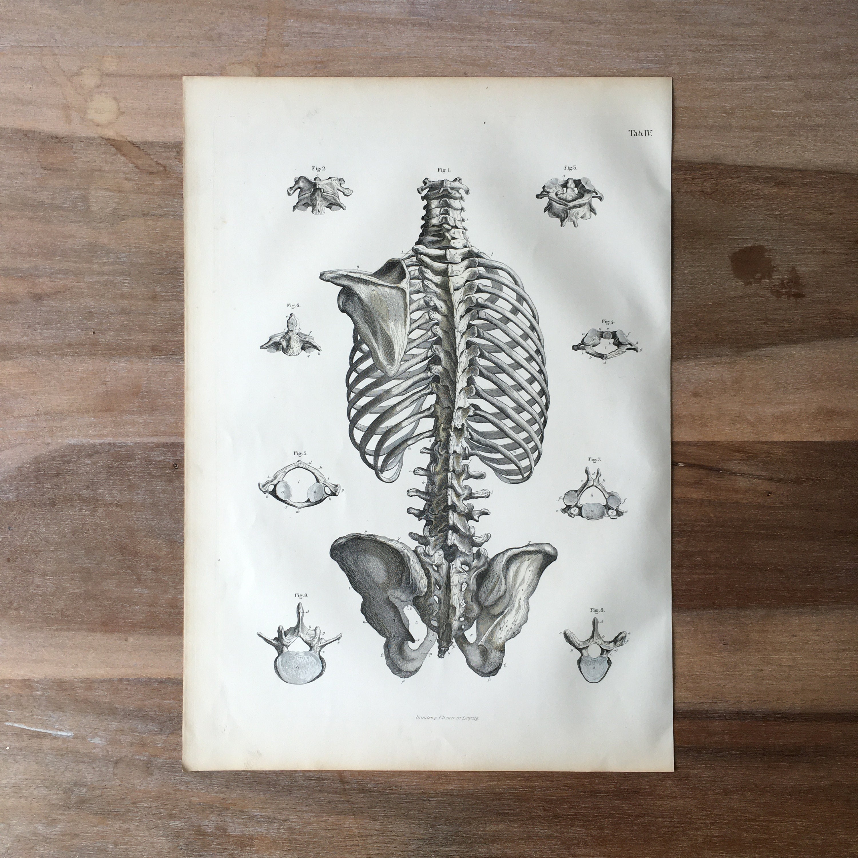 1871 Antique Medical Engraving Human Bones Print spinal column backbone ...
