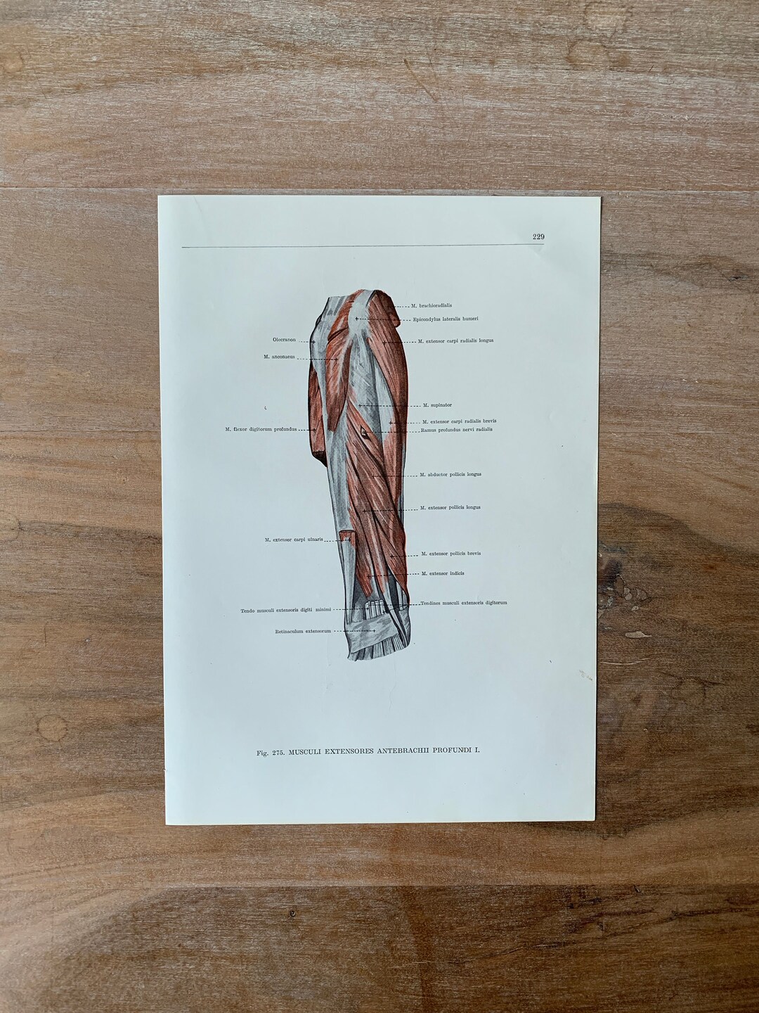 1962 Vintage Human Anatomy, Anatomy Print - Arm Muscles, Human Arm ...
