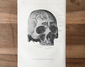 1926年 頭蓋底（頭蓋骨） – ヴィンテージ人体解剖学医療印刷物 - Etsy 日本
