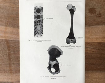 1962 Impressão médica vintage, impressão de osteologia, impressão de corpo humano, impressão de arte de anatomia, impressão de esqueleto humano, ossos de estrutura, osso extraesquelético