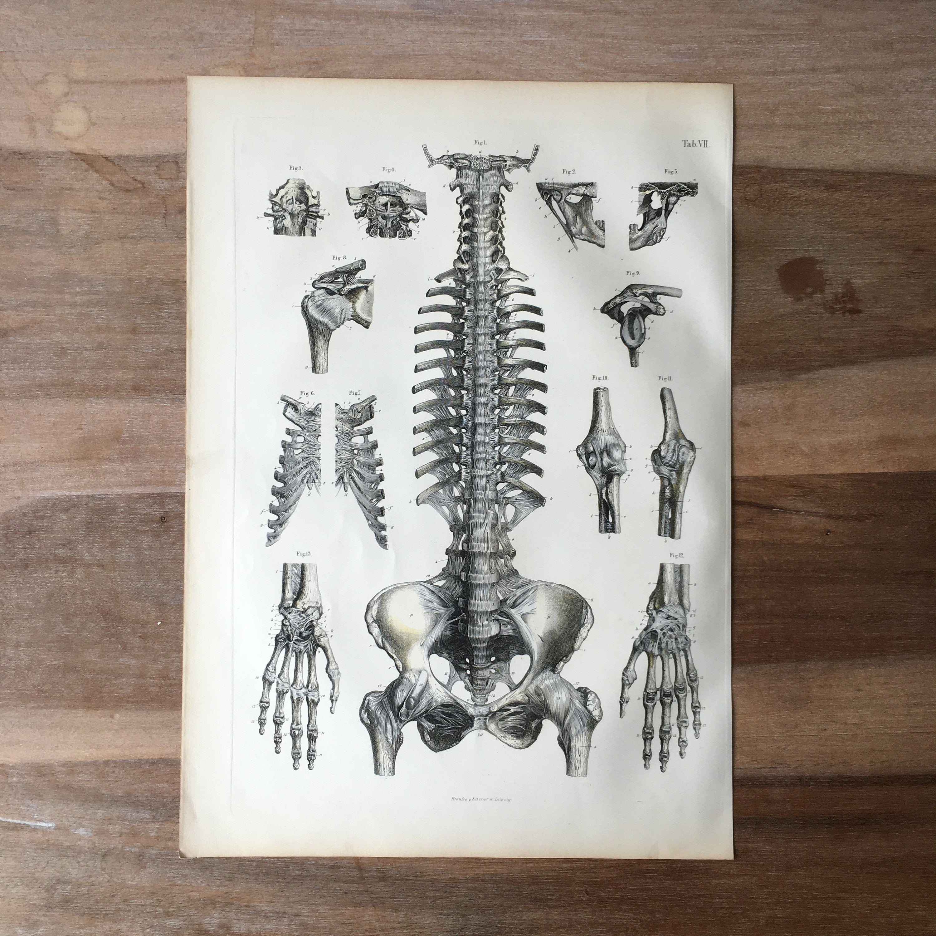 1871 Antique Medical Engraving Human Bones Print spinal column backbone ...