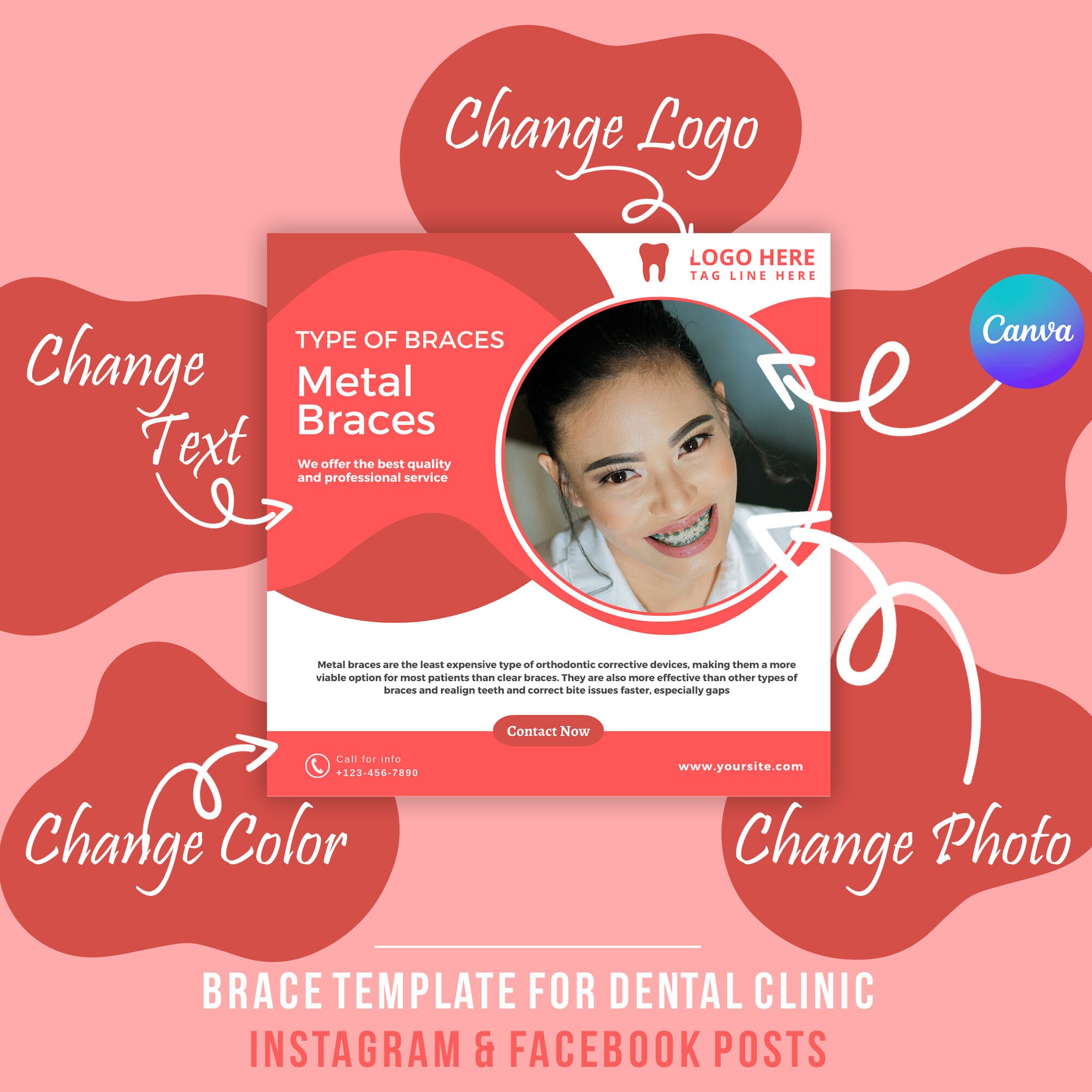 Braces Templates, Pink Instagram Post, Editable Template, Social Media