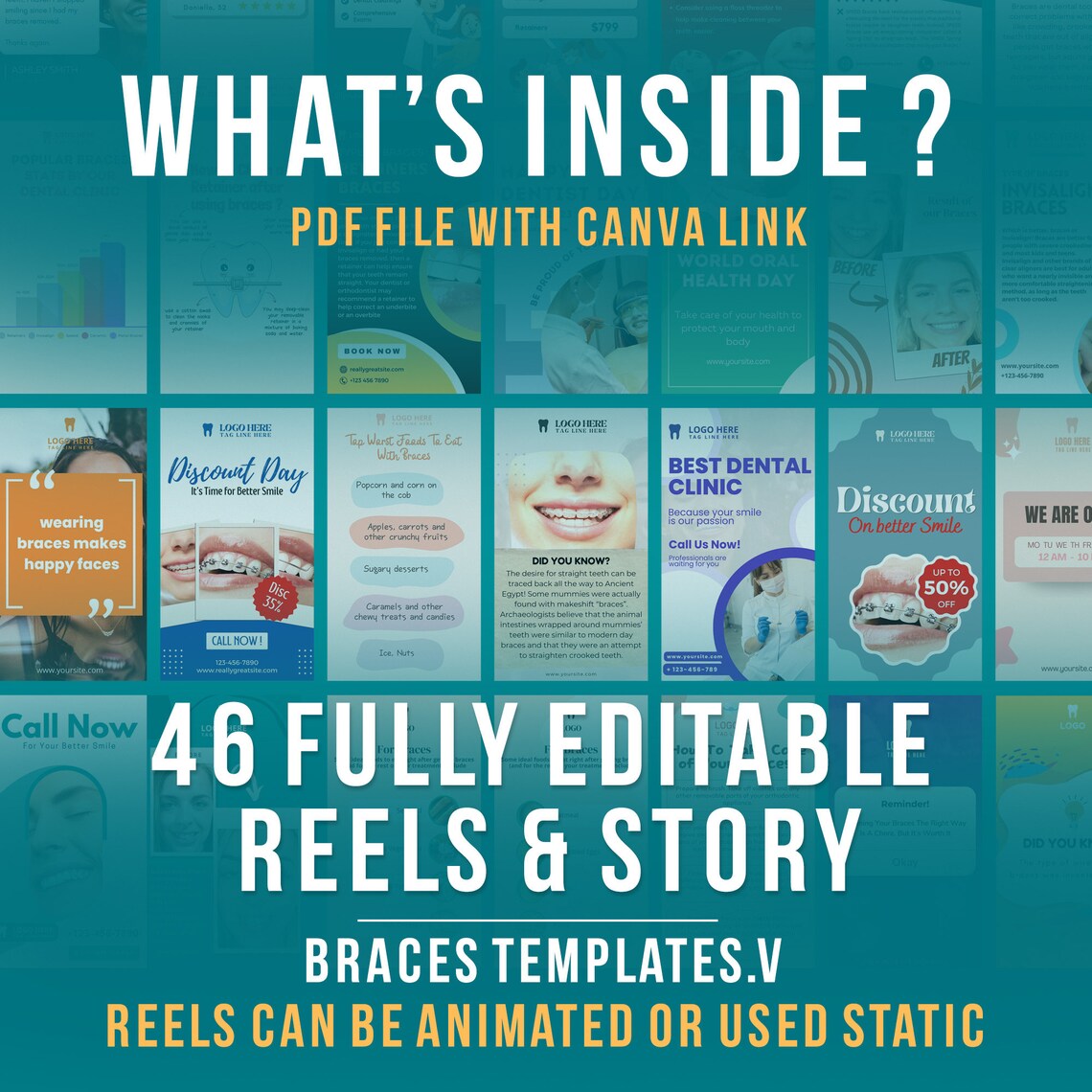 46 Dental Braces Instagram Reels Template Editable Template Etsy