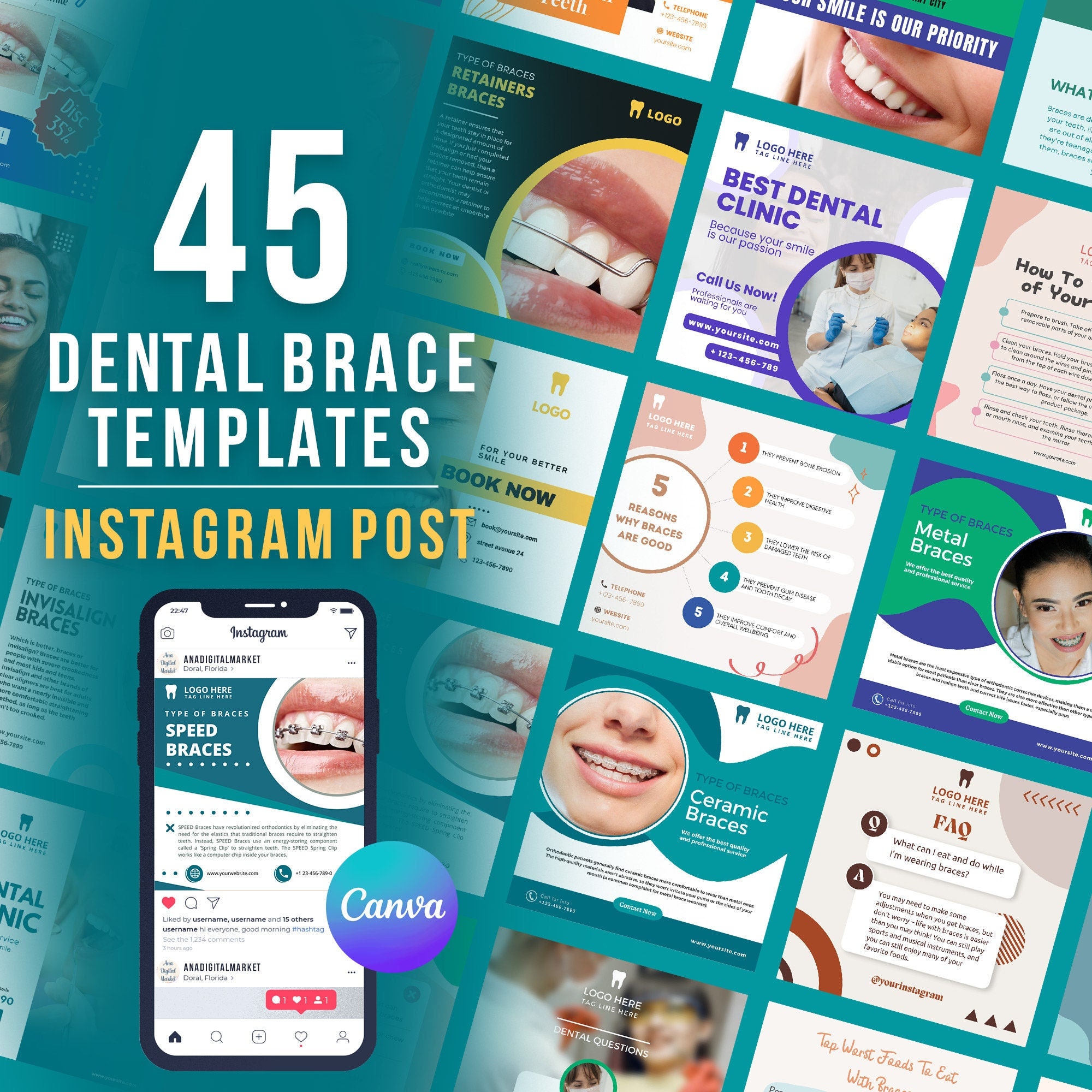 Dental Braces Templates, Instagram Post, Editable Template, Social