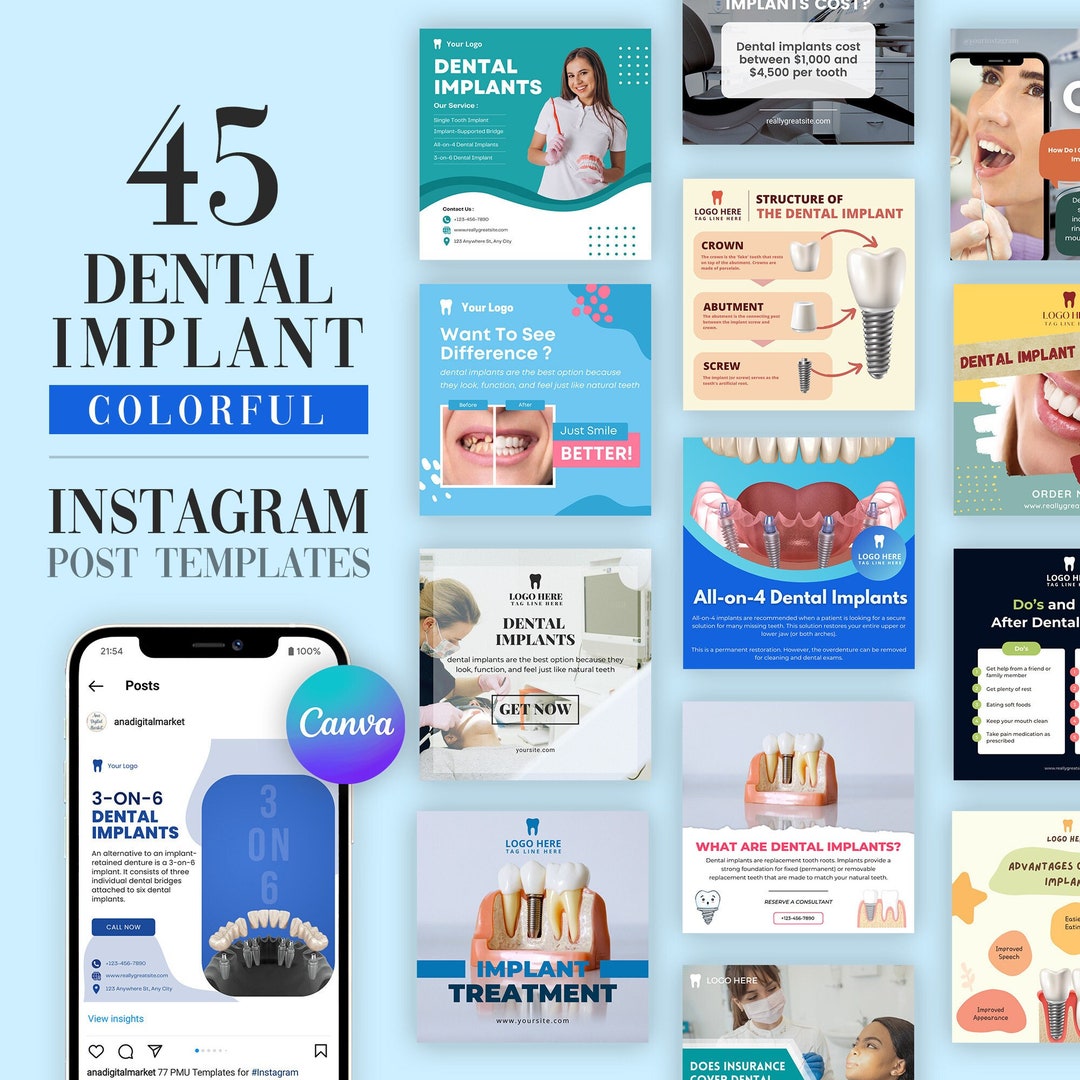 Dental Implant Instagram Post Template, Editable Template for Social