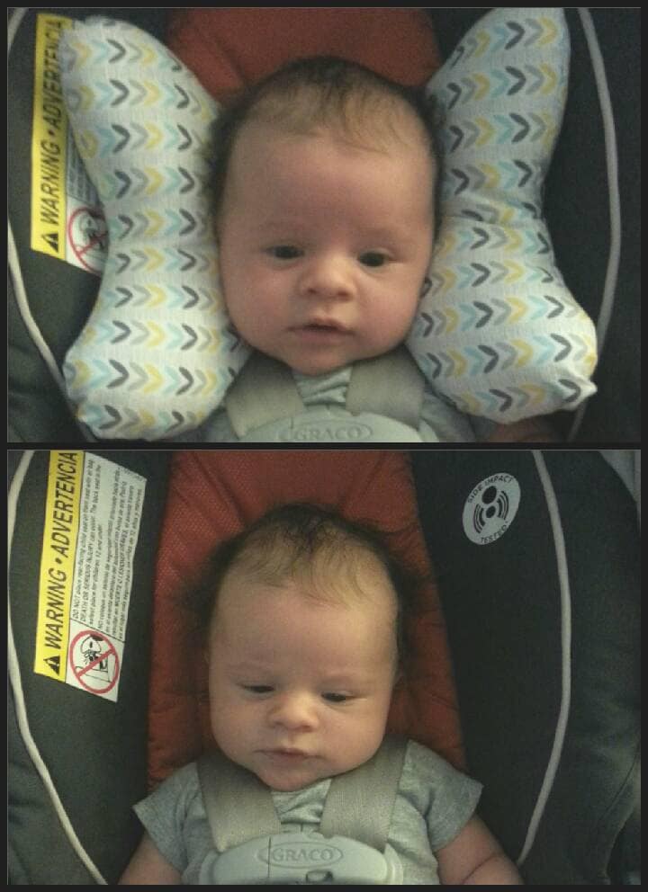 torticollis support pillow