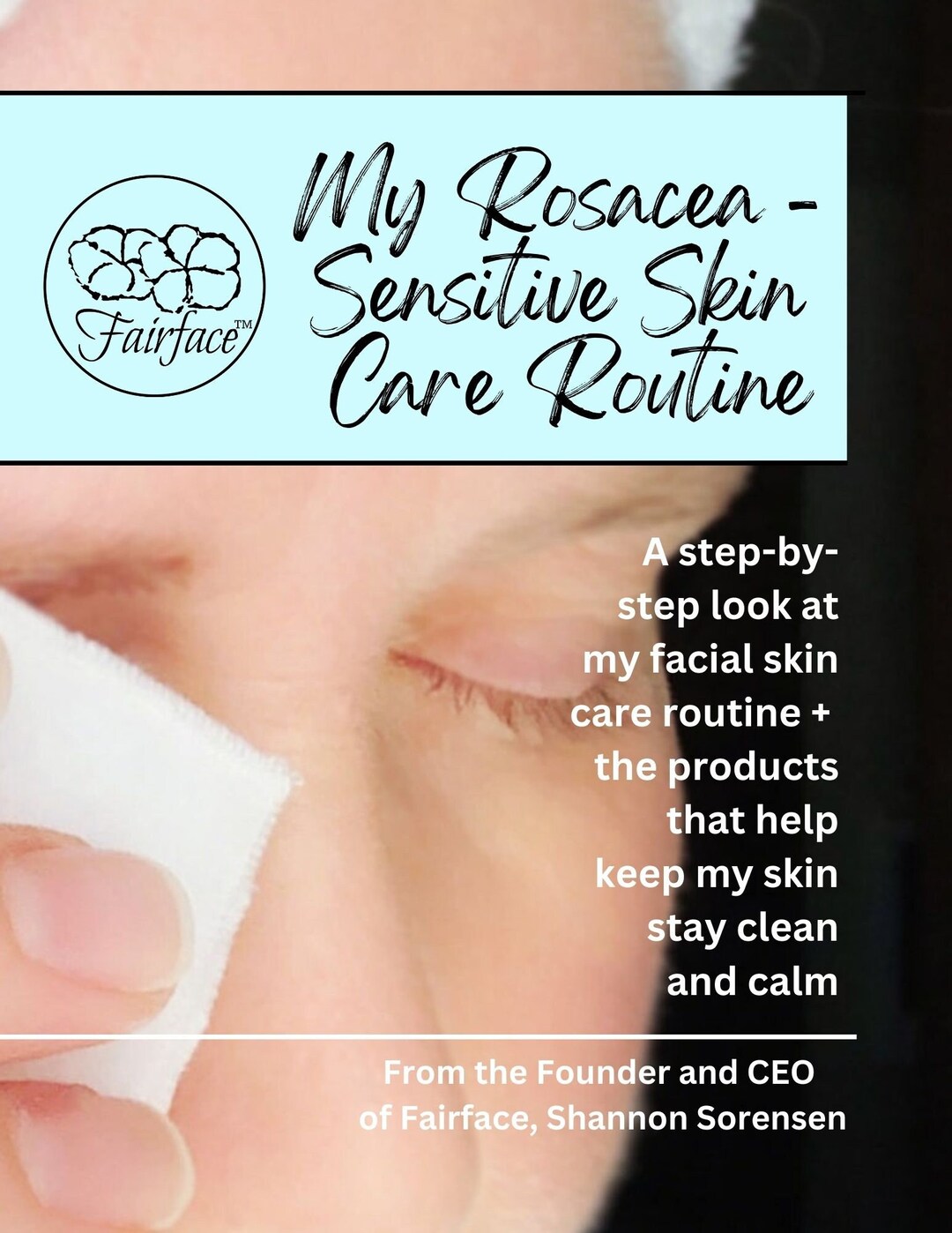 Rosacea & Sensitive Skincare Routine Skin Care Guide Digital Etsy