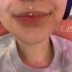 Lippy store loop medusa