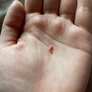 Ready To Ship 4 5 Or 6 Week Gestation Embryo Baby Etsy