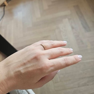 Anne added a photo of their purchase