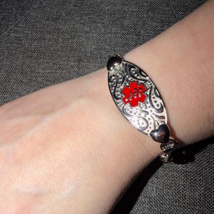 Miss added a photo of their purchase