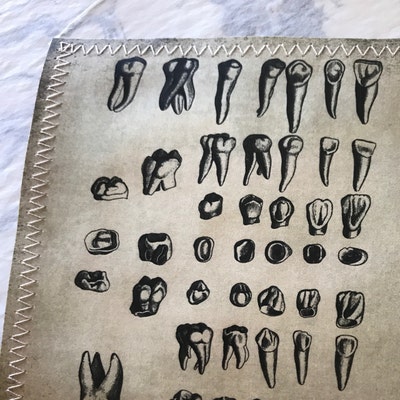 Human Teeth Wall Art, Printable Teeth, Dentist, Dental, Incisors ...