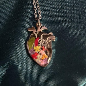 Suzanne added a photo of their purchase