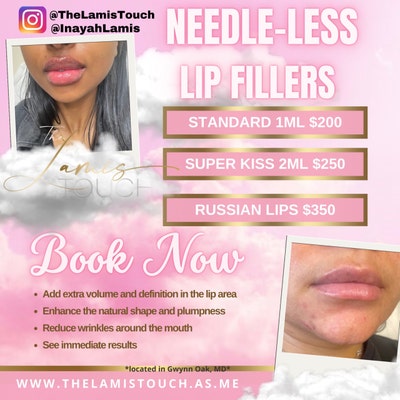 Lip Fillers Flyers Hyaluron Flyer Botox Flyer Facial - Etsy