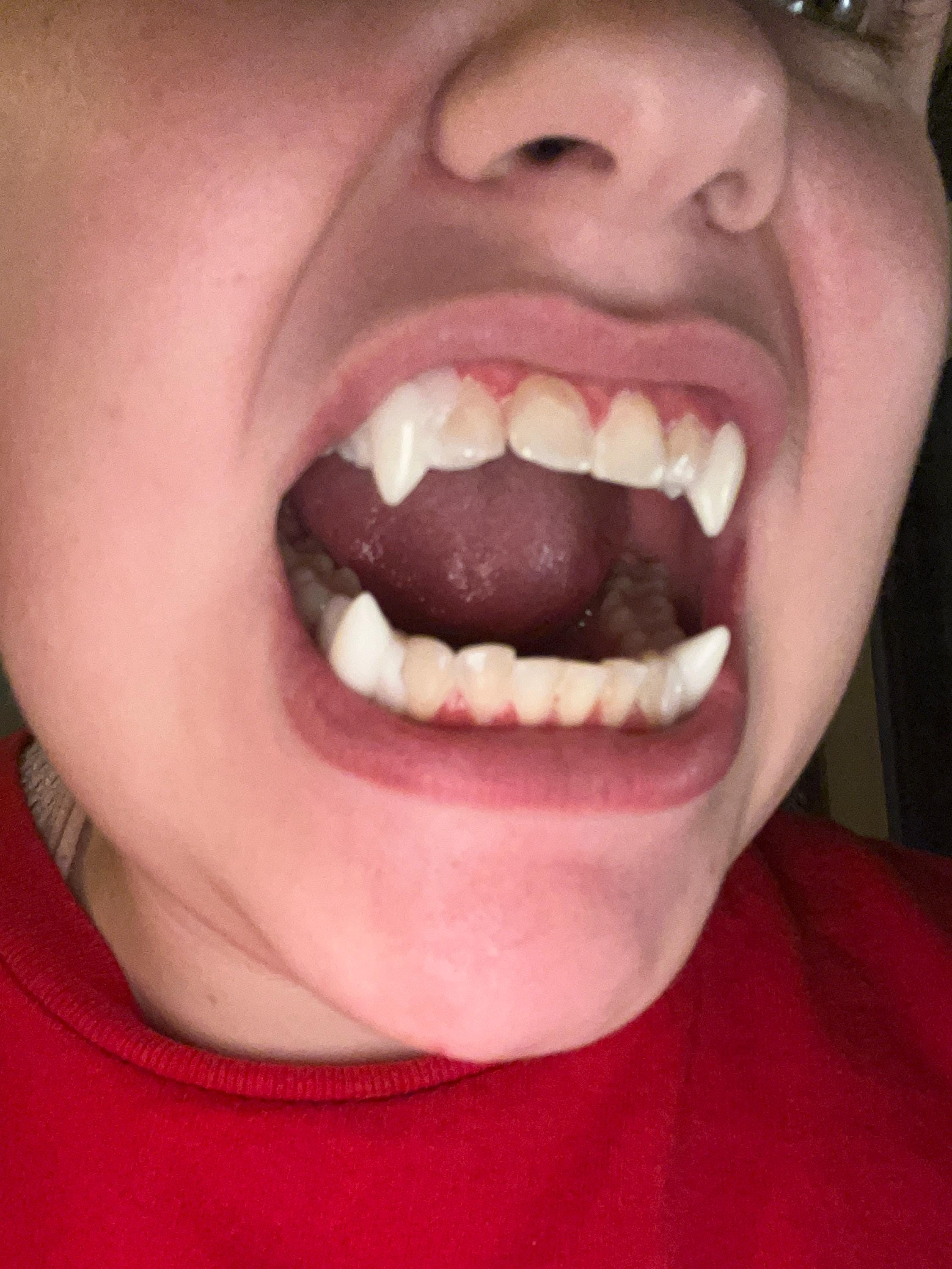 Reusable Fangs with Molding Kit for custom fit natural looking realistic cosplay anime vampire etc