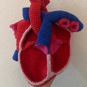 Susan added a photo of their purchase