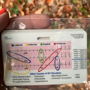 STEMI Reference Tool Horizontal Badge Pocket Card for Nurse Paramedic ...