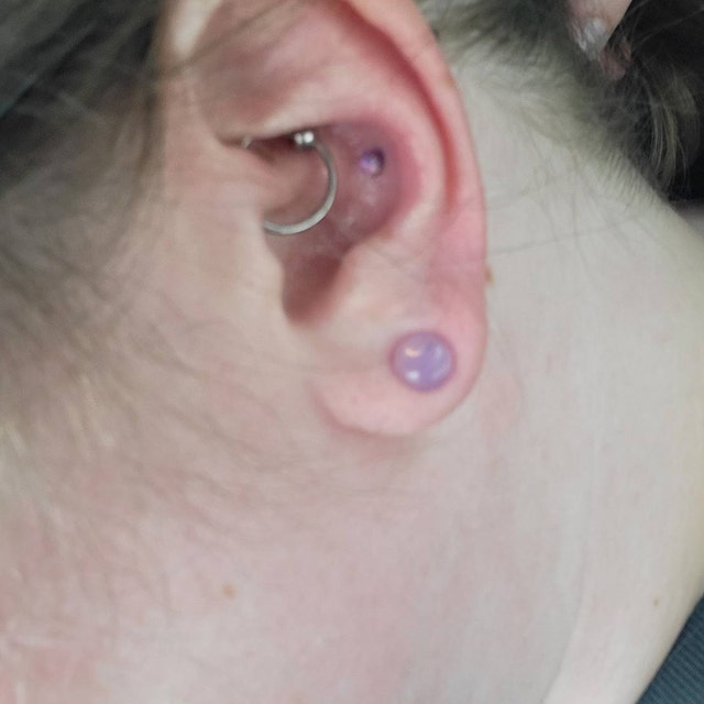 Ear Lobe Piercing Migration Cheap Online clc.cet.edu