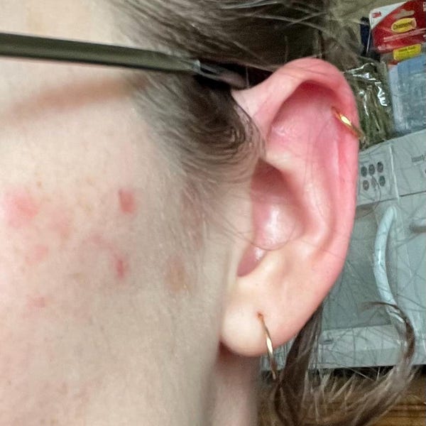 16g Teardrop Medusa Ring • Lippy Loop Labret • Surgical Steel Lip Ring ...