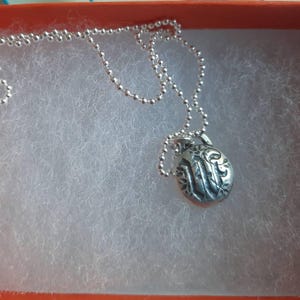 Annie added a photo of their purchase