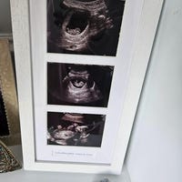 Baby Scan Photo Frame Multi Aperture Frame for Three Scan Sized Photos ...
