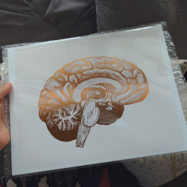 Neuroscience Gift - Neurosurgeon Gift - Brain Anatomy Print - Gold Foil ...