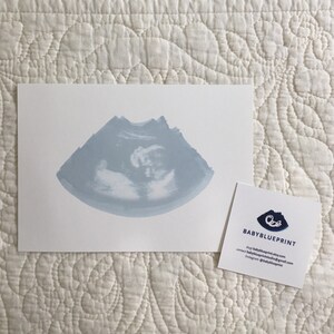 Ultrasound Sonogram ORIGINAL Cyanotype Print 8x10 | Etsy