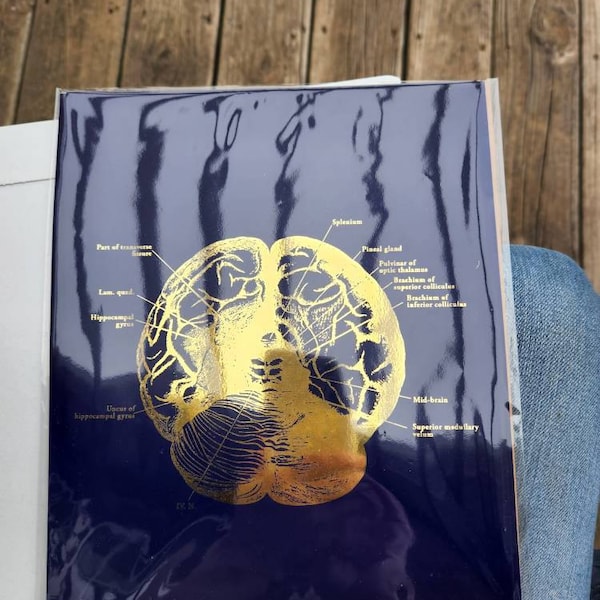 Brain Anatomy Art Foil Print Set of 3 - Medical School - Human Brain ...
