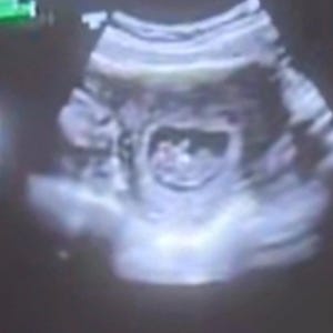 Sierra ha añadido una foto de su compra