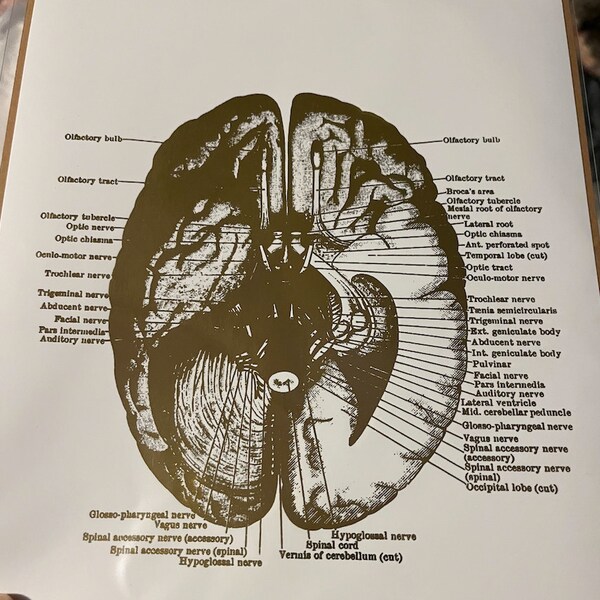 Human Brain Anatomy Medical Student Gift Foil Print - Doctors Office ...