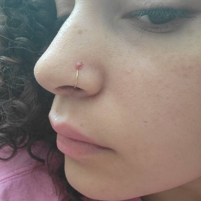 Irritation Get Rid Of Nose Ring Bump Tedy How To Get Rid Of
