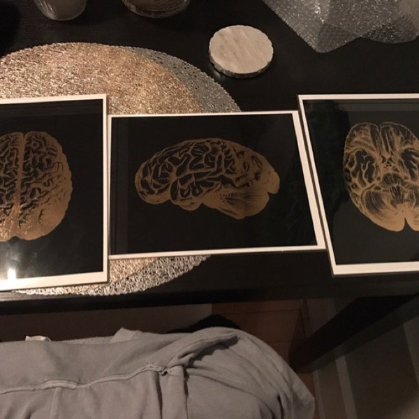 Brain Art Science Art Print - Gold Foil Print - Brain Anatomy Poster ...