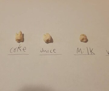 5 Real Human Teeth Molars, Premolars, & Anteriors