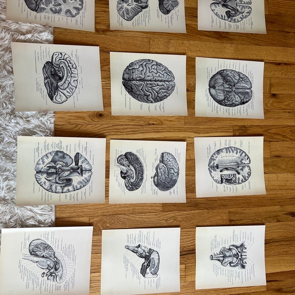 Neurology Vintage Poster Set 12 Brain Anatomy Art Brain Cross Section ...