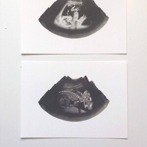 Ultrasound Sonogram ORIGINAL Cyanotype Print 8x10 | Etsy