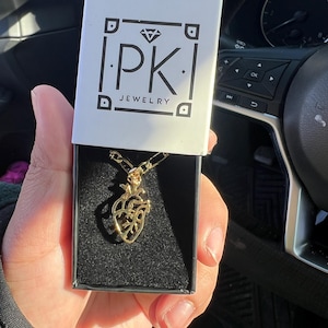 Ana added a photo of their purchase