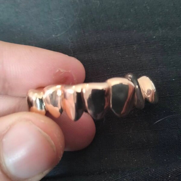 Custom Fit 10K Or 14K Solid Yellow Gold Grillz – Real Gold Teeth, Personalized Fit