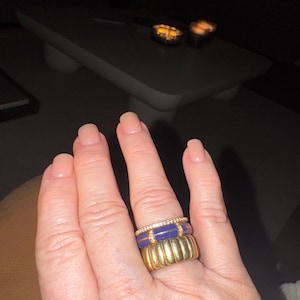 Amy added a photo of their purchase