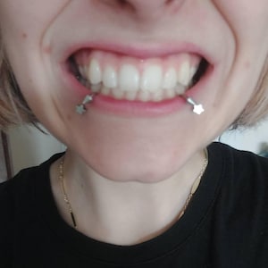 Terézia a ajouté une photo de son achat