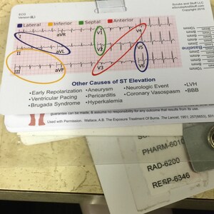 STEMI Reference Tool Horizontal Badge Pocket Card for Nurse Paramedic ...
