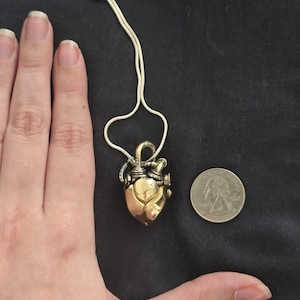 Artemis added a photo of their purchase