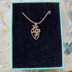 Rhiannan added a photo of their purchase