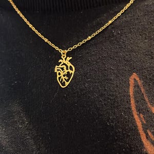 Mila added a photo of their purchase