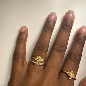 Chinelo added a photo of their purchase