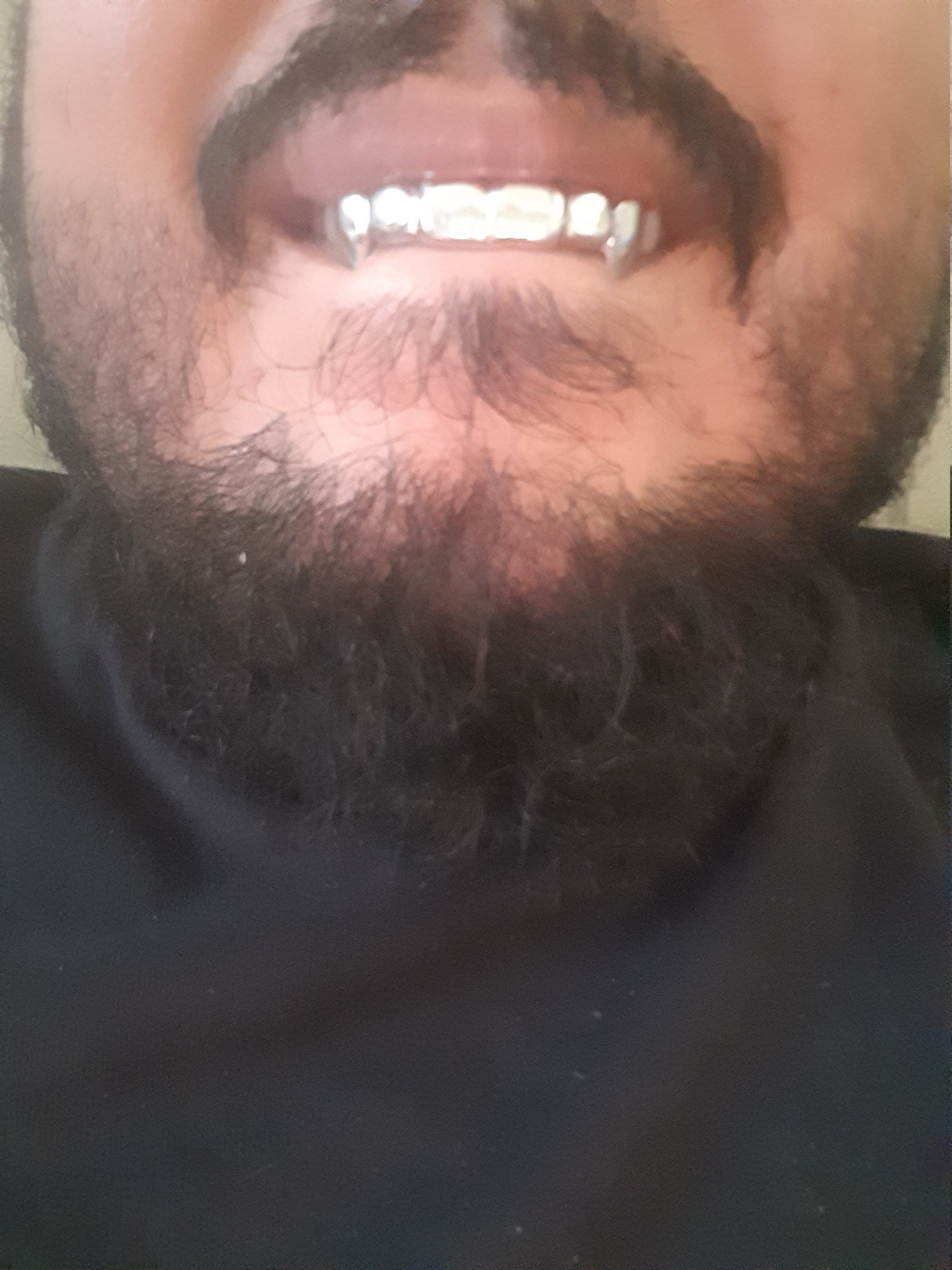 925 Sterling Silver Custom fit Grillz Plain Silver teeth REAL Grill Grillz.