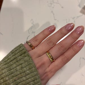 Allison added a photo of their purchase