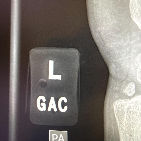 Lead Numbers Radiology Lead Letters for X-ray Markers: DIY Radiology Identification - Etsy