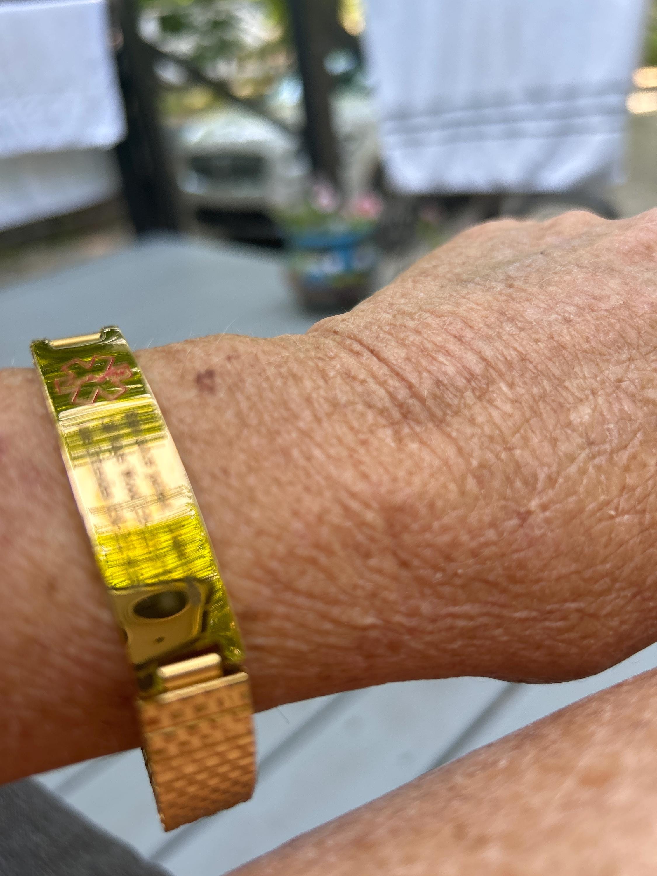 Personalized Medical Alert Bracelet for Men,Including Medical Information and Contact ID,Gift for Epilepsy, Hypertension, Dizziness Patient