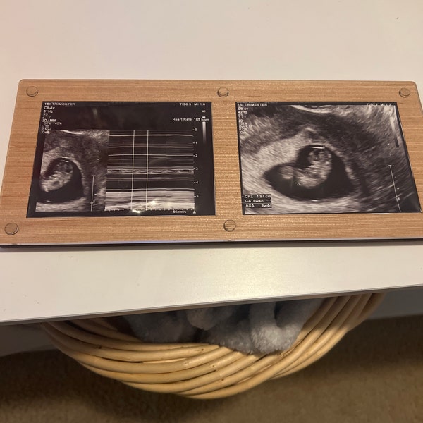 Personalized Ultrasound Frame With Baby Name Engraved - Sonogram ...
